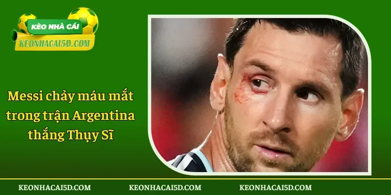 Messi chảy máu mắt trong trận Argentina thắng Thụy Sĩ